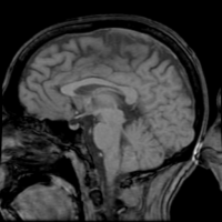 [Fred Wheeler MR Sagittal Head]